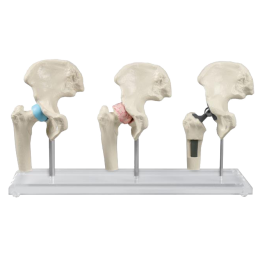 Modèle anatomique Erler Zimmer « Torse avec dos ouvert » acheter à